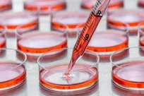 سازمان انتقال خون محور توسعه بانک سلول‌های بنیادی غیرخویشاوند