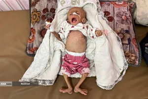 بحران گرسنگی فزاینده غزه