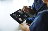 study-links-head-size-to-risk-of-dementia-later-in-life