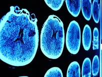 Study links head injuries to increased risk of brain cancer mortality