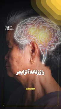 راز زنانه آلزایمر
