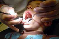 اجرای برنامه‌های جامع سلامت دهان و دندان برای میلیون‌ها دانش‌آموز