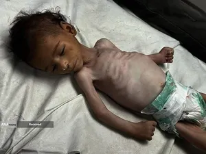 گرسنگی فاجعه بار در غزه