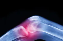 Single stem cell injection cuts osteoporosis-related fractures by 94%