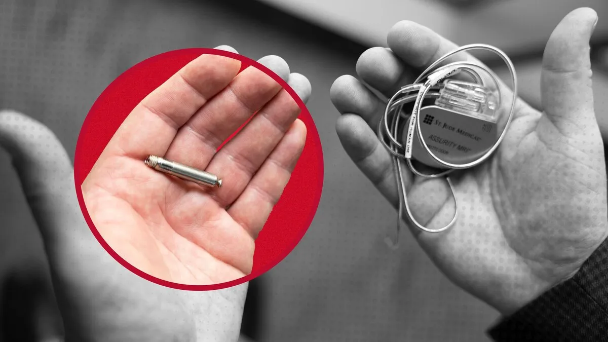 پیشتازی کشور در فناوری ضربان‌سازهای بدون سیم