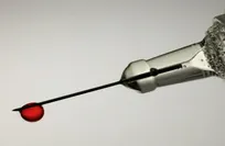 Simple blood test could detect cancer at “Stage Zero”