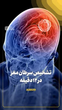 تشخیص سرطان مغز در ۱۲ دقیقه