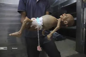 کودکان غزه در صف مرگ بدلیل سوء&zwnj;تغذیه، گرسنگی، و کمبود کمک&zwnj;ها و خدمات حیاتی