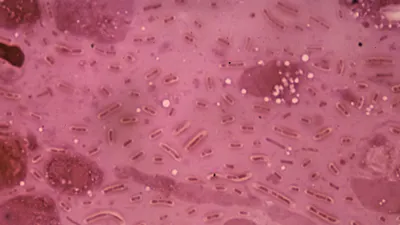 Klebsiella pneumoniae