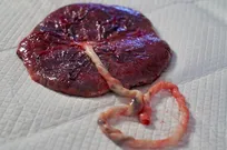 جفت؛ معماری شگفت‌انگیز طبیعت برای اتصال ۲ زندگی