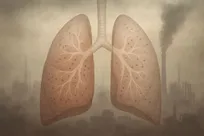 آلودگی هوا بخش بزرگی از فواید ورزش را خنثی می‌کند