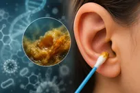 جرم گوش سرنخی برای تشخیص زودهنگام بیماری‌ها است