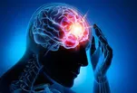 از عقب‌ماندگی درمان تا از دست رفتن زمان طلایی؛ زنگ خطر سکته مغزی در ایران