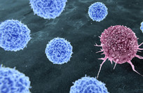 Obesity may account for more than 11% of cancer cases, study finds