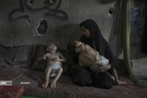 کودکان غزه در صف مرگ بدلیل سوء&zwnj;تغذیه، گرسنگی، و کمبود کمک&zwnj;ها و خدمات حیاتی