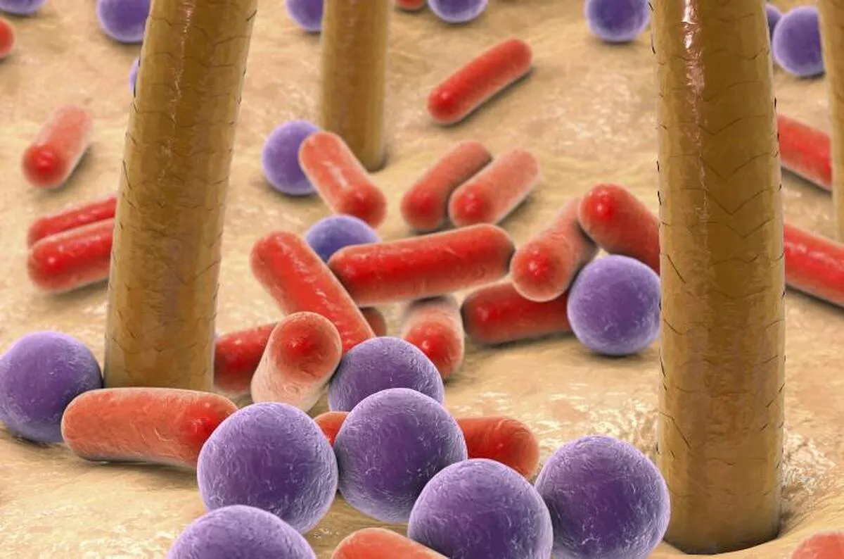 Certain Skin Bacteria Can Inhibit Growth of Antibiotic-Resistant Bacteria