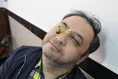 یک تیر و چند نشان با پرورش حلزون کُلاژن‌ساز