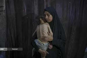کودکان غزه در صف مرگ بدلیل سوء&zwnj;تغذیه، گرسنگی، و کمبود کمک&zwnj;ها و خدمات حیاتی