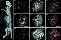 Micro-CT systems deliver micrometer-resolution imaging
