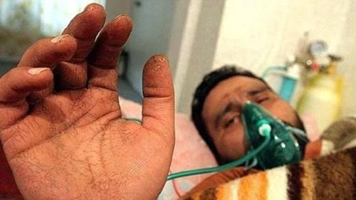 جانبازان شیمیایی نباید گمنام بمانند / تدوین «دانشنامه و موزه جانبازان شیمیایی» و موزه شهدا هنوز به نتیجه نرسیده است