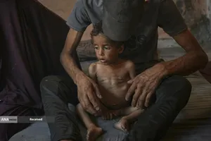 کودکان غزه در صف مرگ بدلیل سوء&zwnj;تغذیه، گرسنگی، و کمبود کمک&zwnj;ها و خدمات حیاتی