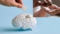 Genetic profile may determine who benefits from aspirin against dementia