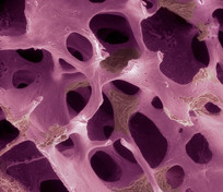 One-time cell injection offers new hope for osteoporosis treatment